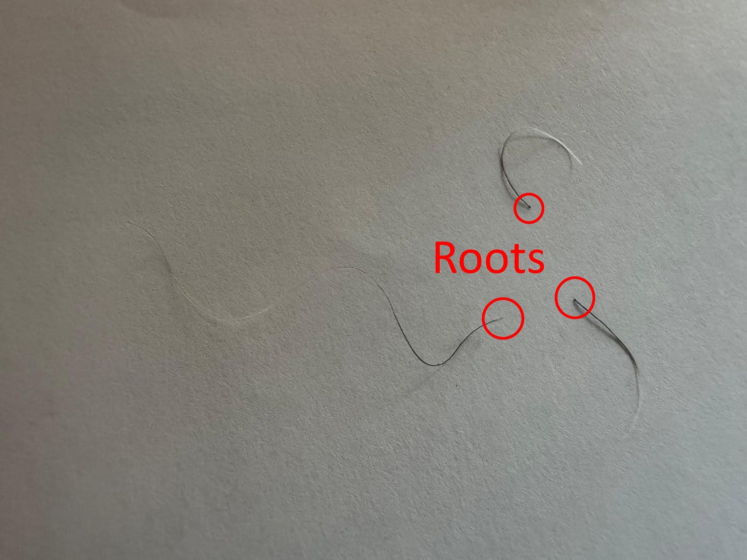 The Startup Executive Who Grew His Hair Back by Changing The Tuning Of His Music